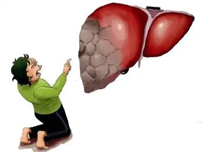 补硒后眼睛发黄(眼睛发黄补硒后会恢复吗)-硒宝网