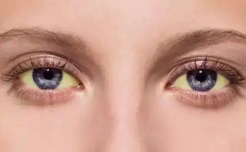 补硒后眼睛发黄(眼睛发黄补硒后会恢复吗)-硒宝网