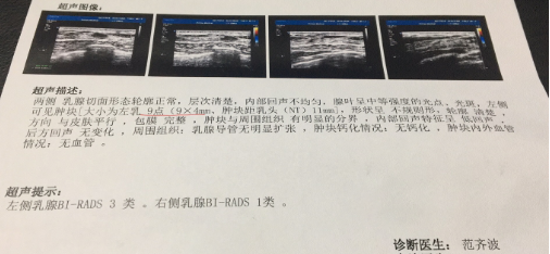 乳腺结节要补硒(乳房有结节补硒管用吗)-硒宝网
