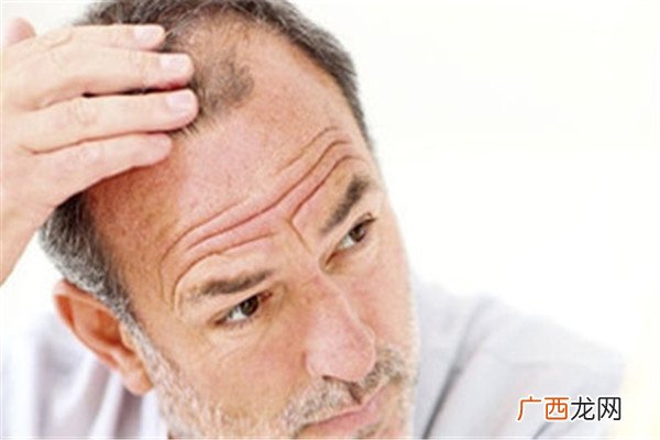 缺少什么微量元素会掉头发(头发缺少微量元素会脱发吗)-硒宝网