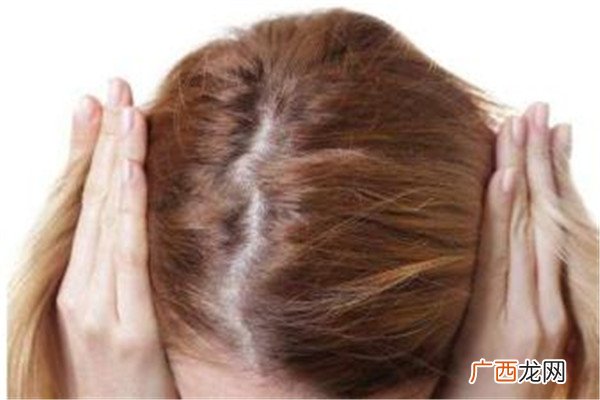 缺少什么微量元素会掉头发(头发缺少微量元素会脱发吗)-硒宝网