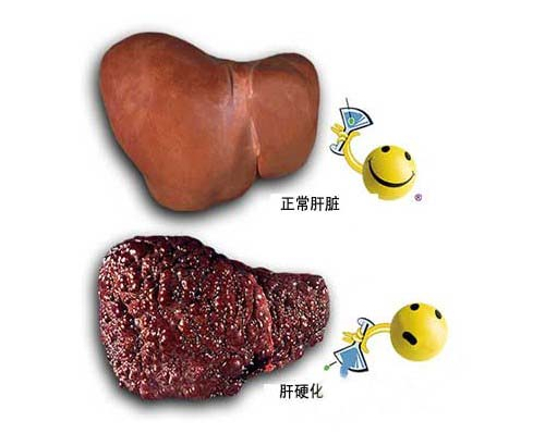 肝癌病人 补硒（得了肝癌补硒管用吗）-硒宝网