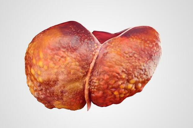 肝癌病人 补硒（得了肝癌补硒管用吗）-硒宝网