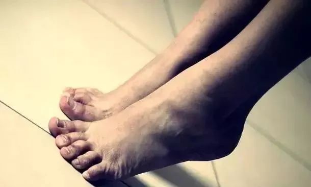 补硒后皮肤发黄(发黄补皮肤硒后会变白吗)-硒宝网