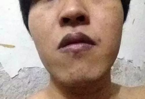 补硒后皮肤发黄(发黄补皮肤硒后会变白吗)-硒宝网