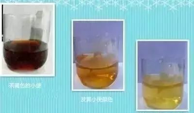 补硒后皮肤发黄(发黄补皮肤硒后会变白吗)-硒宝网