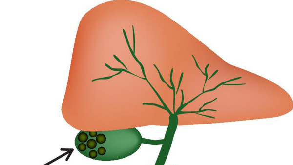 补硒对肝脏好吗(肝病患者补硒)-硒宝网