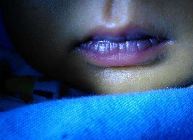 补硒预防脑出血（出血脑预防补硒吃什么药）-硒宝网