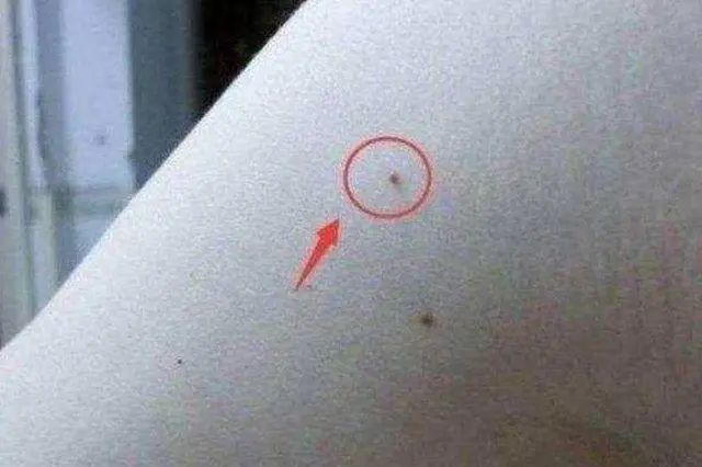 补硒防癌有用吗（补硒防癌）-硒宝网