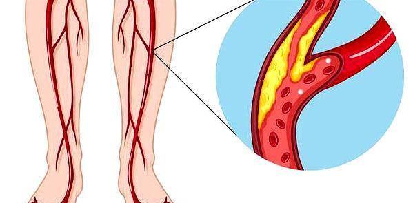 补硒的金属元素（金属硒元素的作用与功效）-硒宝网