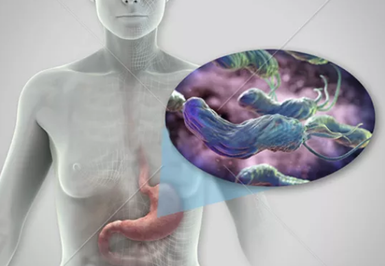 蒌缩性胃炎补硒（萎缩性胃炎硒酵母片）-硒宝网