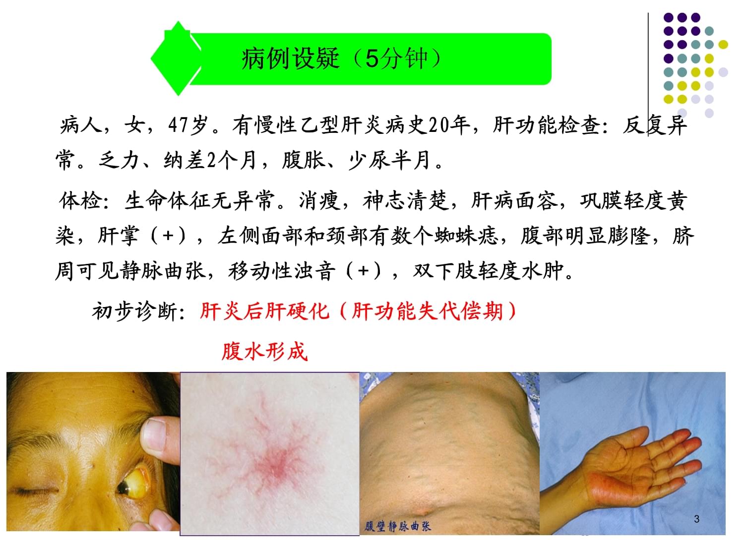 肝硬化什什补硒(肝硬化补硒有没有效果)-硒宝网