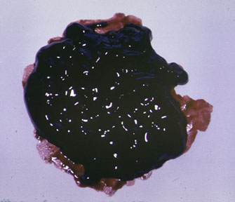 补铁拉屎会是黑色的吗（黑色拉屎补铁会是黑便吗）-硒宝网