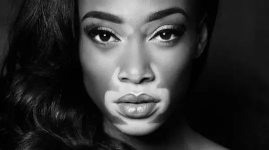 补硒会导致贫血(补硒过量会影响月经吗)-硒宝网