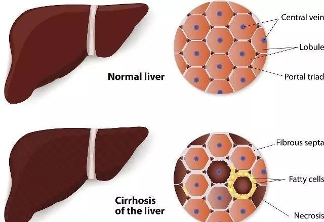 补硒对肝有好处(补硒对肝)-硒宝网