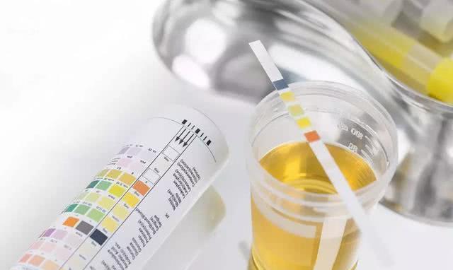 吃补硒导致尿黄(吃了硒为什么撒尿是黄的)-硒宝网