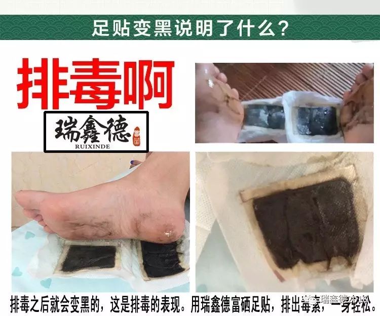 富硒食物能补钠（钠的作用和补硒的好处）-硒宝网