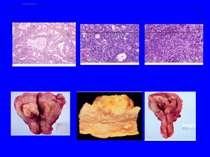补硒大便会黑吗(吃硒大便黑色)-硒宝网