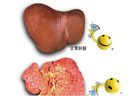 脂肪肝怎么补硒(脂肪肝补硒有用吗)-硒宝网