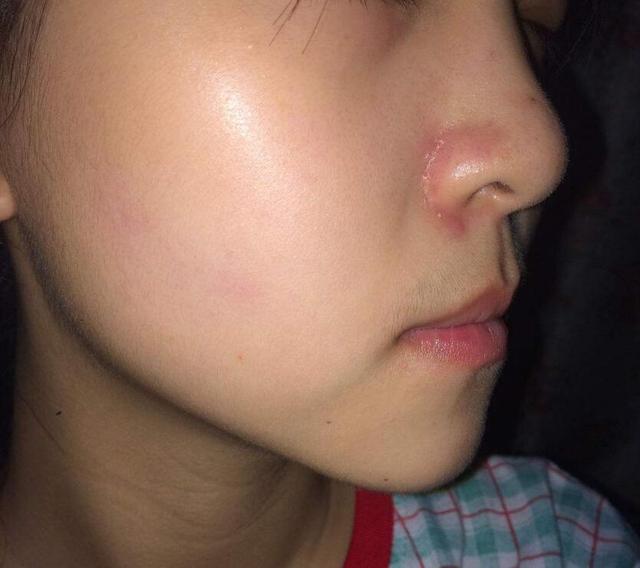 胃不好如何补硒（硒对胃好吗）-硒宝网