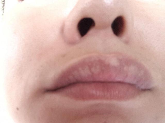 胃不好如何补硒（硒对胃好吗）-硒宝网