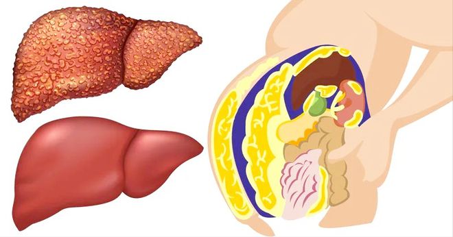 排肝毒怎么补硒(补硒肝脏)-硒宝网