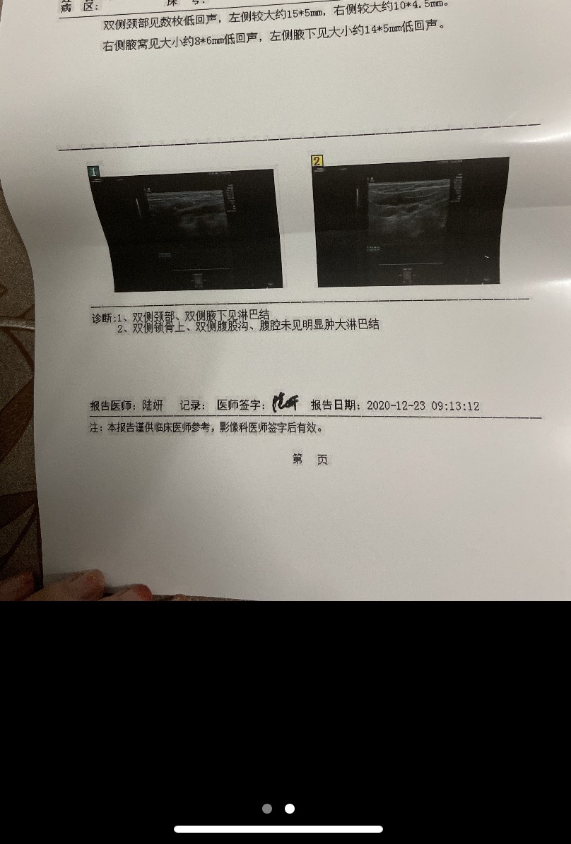 淋巴癌补硒治疗（淋巴瘤补硒有效果吗）-硒宝网