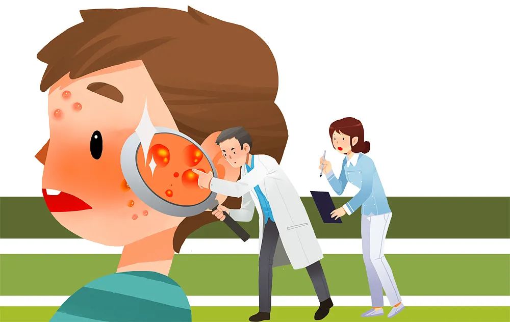 长痤疮要补硒吗(痤疮为什么要用硒酵母片)-硒宝网