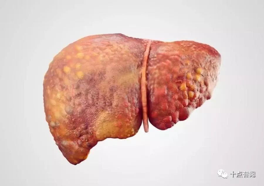 补硒对肝掌有用（补硒对肝病有效吗）-硒宝网