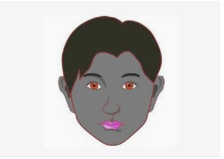 肝掌需要补硒吗（补硒对肝病患者有好处吗）-硒宝网