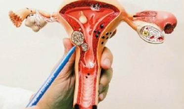 卵巢癌化疗补硒（化疗期间补硒多少量）-硒宝网