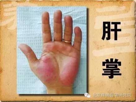 肝掌需要补硒吗(补硒肝脏)-硒宝网