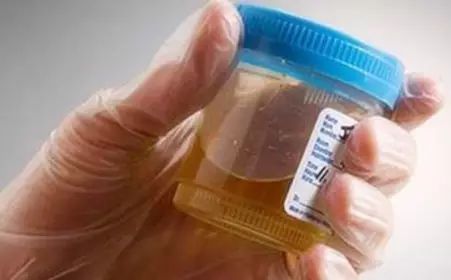 补硒预防糖尿?。ㄔし啦〔固悄蛭姆椒ǎ?硒宝网