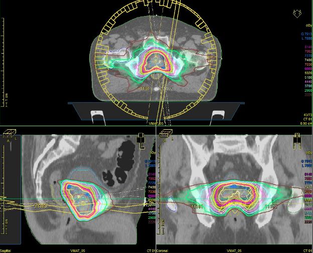 乳腺癌晚期补硒（乳腺癌患者补硒元素好吗）-硒宝网
