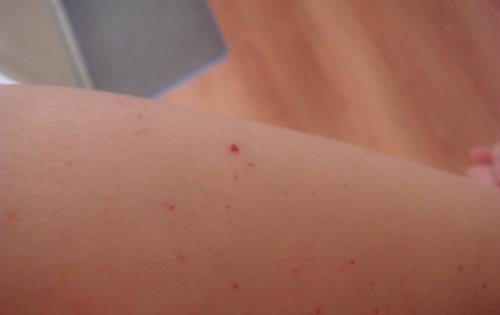 补硒能不能喝酒(喝酒能吃硒吗)-硒宝网