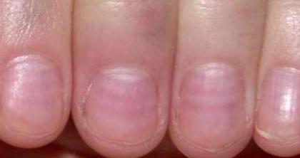 补硒溃疡结肠炎(补结肠炎溃疡硒片吃多久)-硒宝网