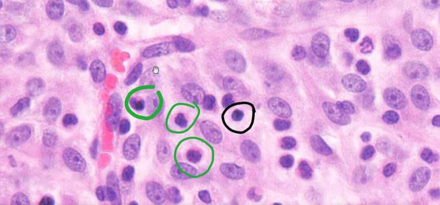 补硒后脸干口干（补硒后便秘是什么原因）-硒宝网