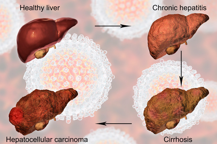 补硒肿瘤标志物(肿瘤硒)-硒宝网