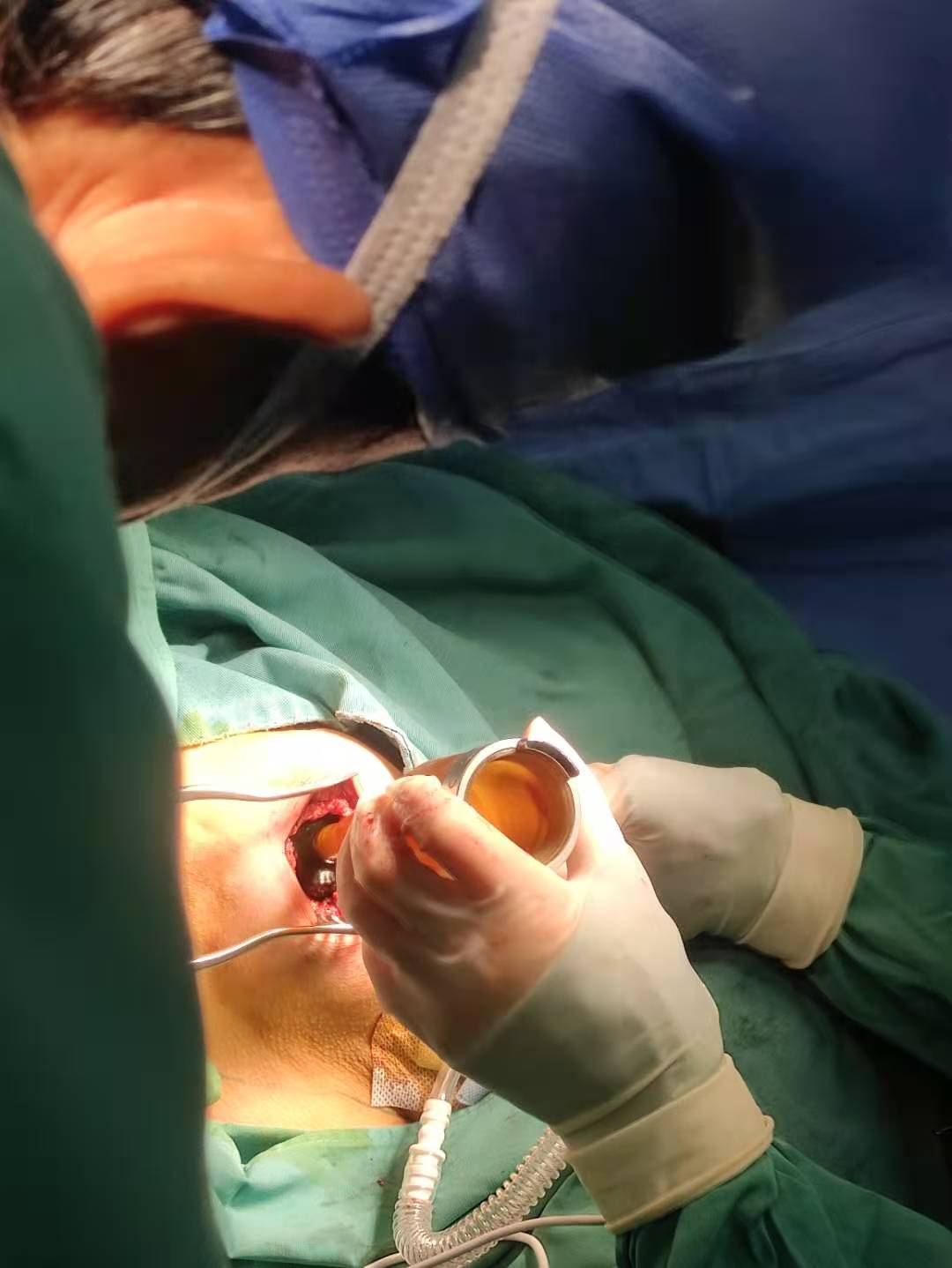 乳腺癌手术补硒(癌手术乳腺补硒吃什么好)-硒宝网