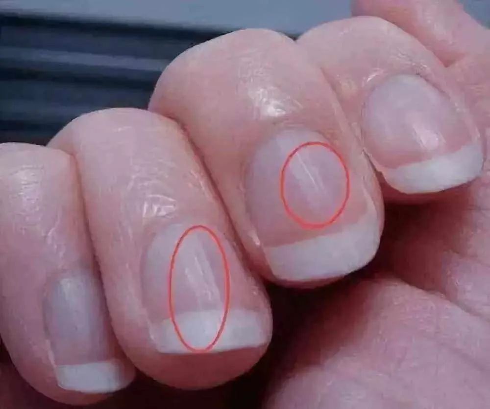 补硒后老想睡觉（补硒对睡眠有改善没）-硒宝网