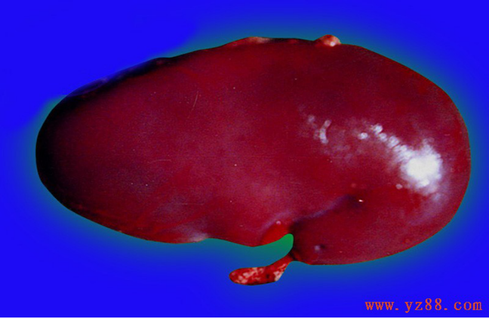 补硒能治肠炎么（能治补肠炎硒的中药）-硒宝网