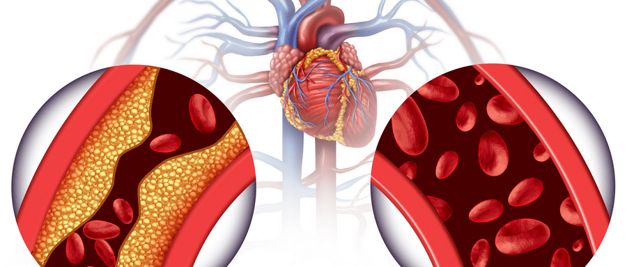 补硒后会出血吗（补硒会引起便血吗）-硒宝网