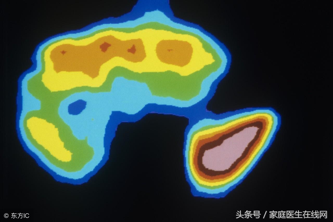 肝癌补硒有用吗（补肝癌硒用有效果吗）-硒宝网