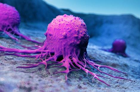 补硒治疗乳腺癌（乳腺癌补硒一天用量是多少）-硒宝网