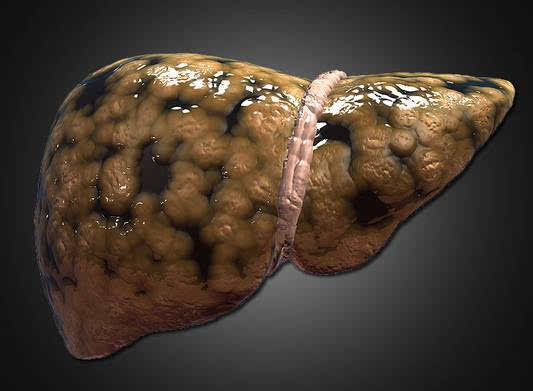 肝衰竭能补硒吗(硒对肝脏)-硒宝网