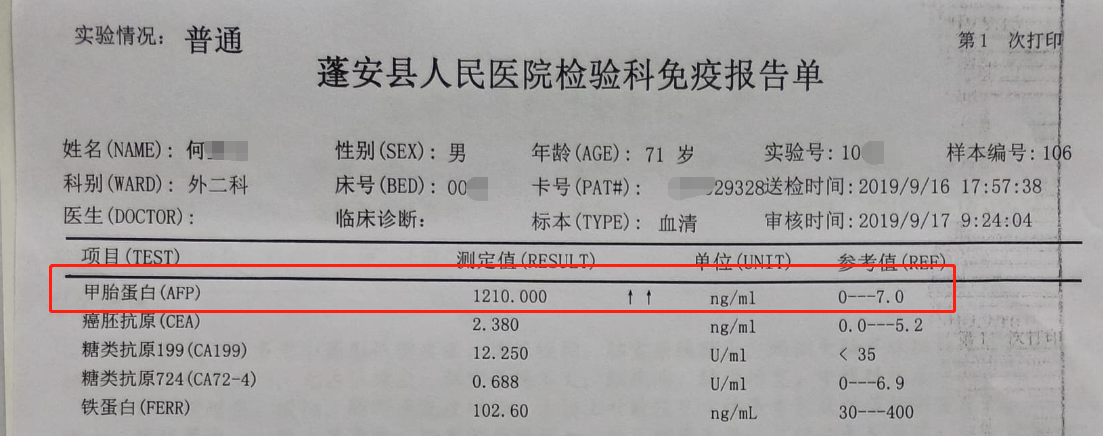 甲胎蛋白高补硒（甲胎蛋白高补硒）-硒宝网