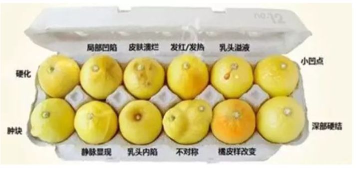 乳腺癌如何补硒(补硒对乳腺癌的作用)-硒宝网