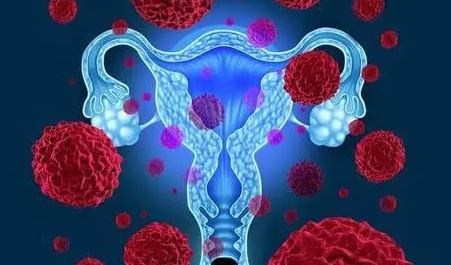 宫颈癌如何补硒(硒片对宫颈癌)-硒宝网