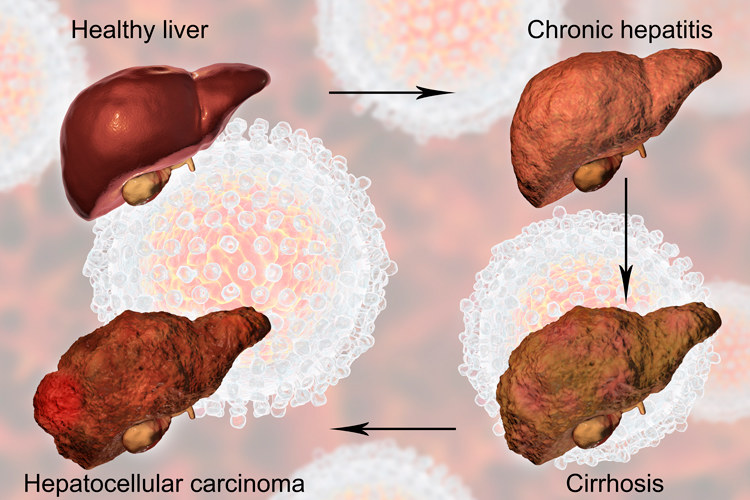 肾移植能补硒吗(肾移植能吃补锌片吗)-硒宝网