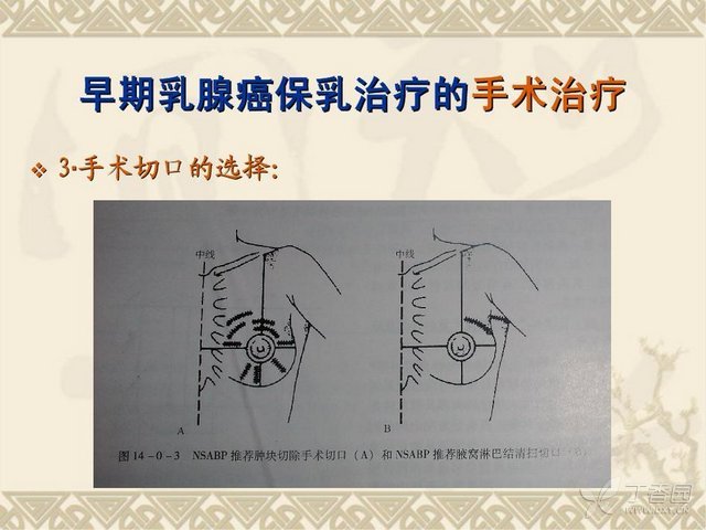 乳腺癌补硒水果(乳腺癌患者吃保健品硒好吗)-硒宝网